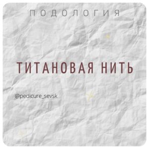 Титановая нить. Вросший ноготь коррекция