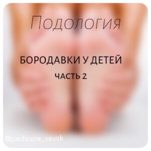Подошвенная бородавка у детей